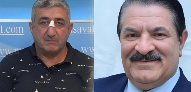 Ağadadaş Ağayevin balta atdığı mühafizəçi həbs edildi