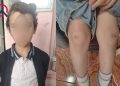 "4-cü sinif şagirdi nəvəmi məktəbin ayaqyolunda döyüb" - FOTOLAR